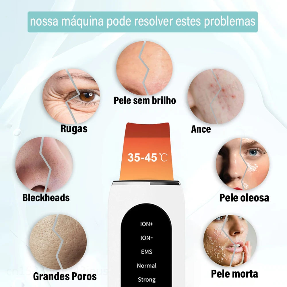 Aparelho ultrassônico para pele, peeling, removedor de cravos, limpeza profunda do rosto, íon ultrassônico, limpador de poros.